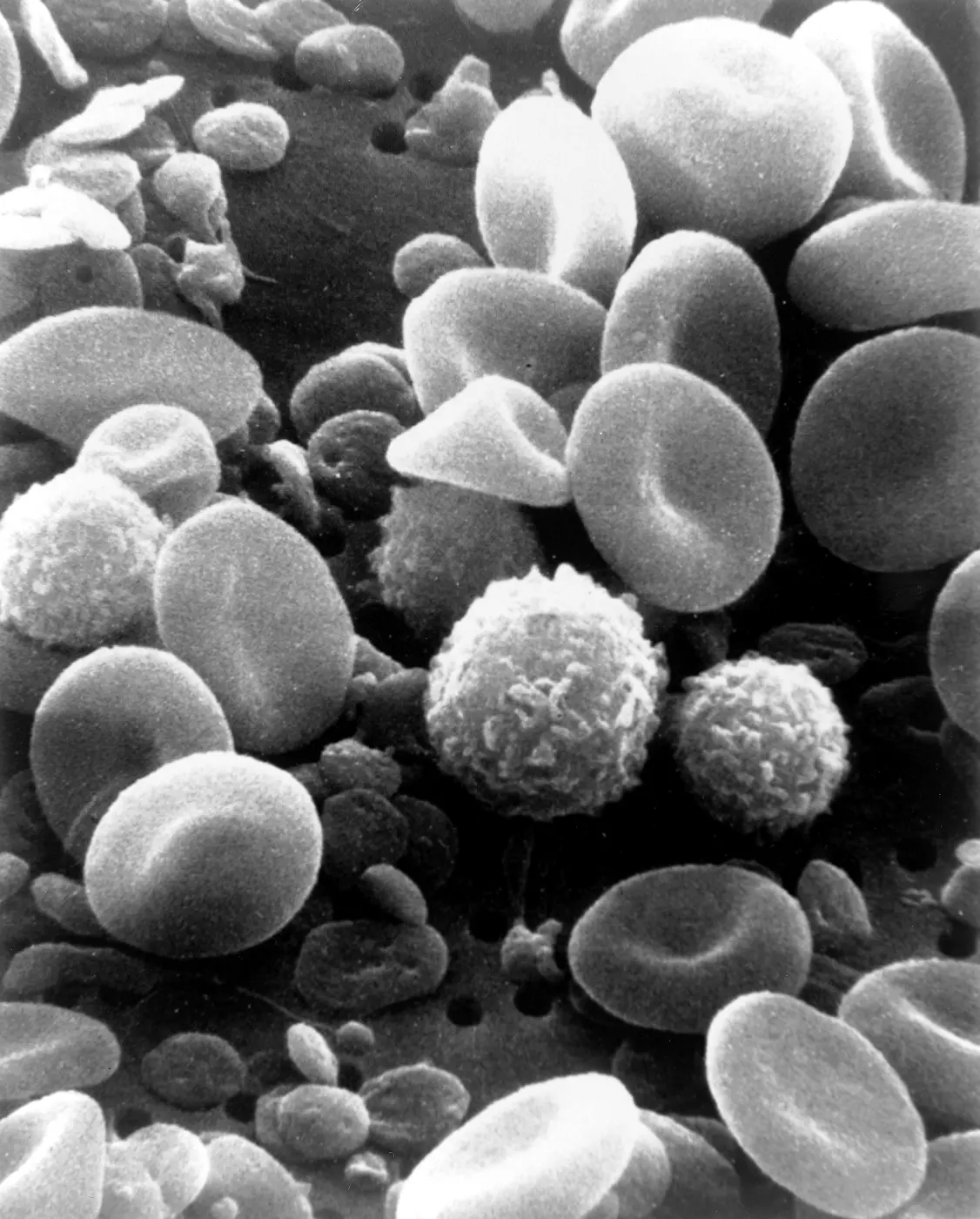 Scanning electron micrograph of human blood: red blood cells, white blood cells and platelets