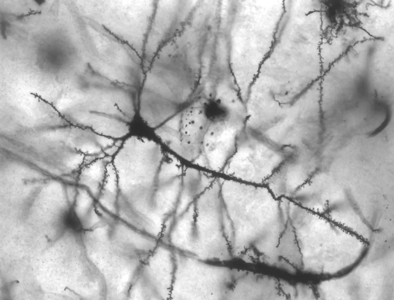 Micrograph of a stained nerve cell with many branching extensions on a light background