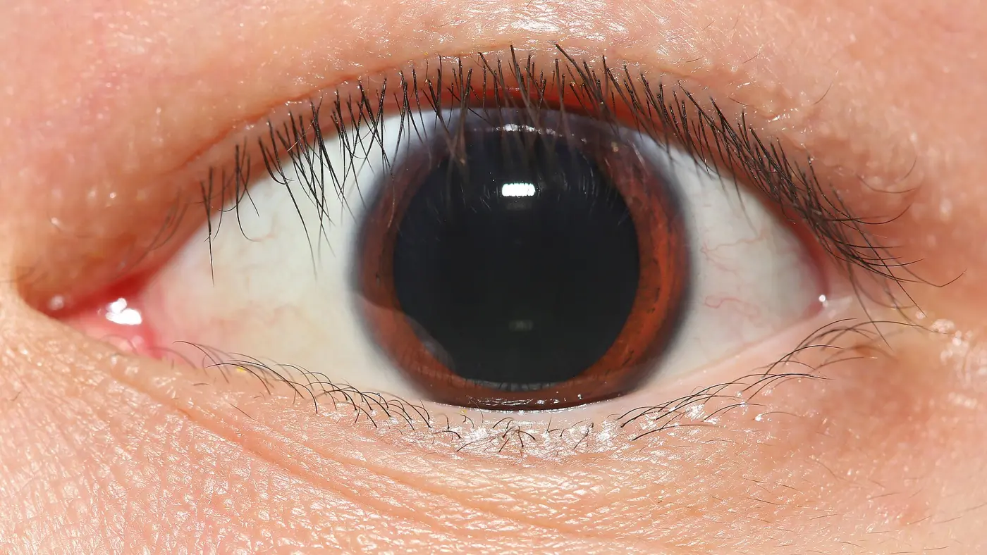 Close-up of a human eye with a wide-open pupil in low light
